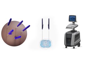 nanoknife-ameliyatsiz-prostat-kanseri-tedavileri